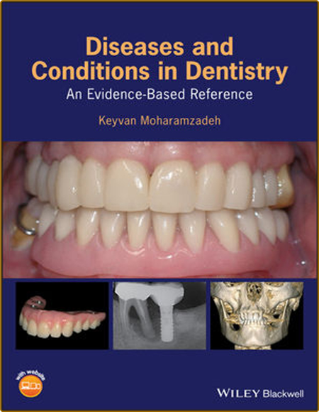 Moharamzadeh K  Diseases and Conditions in Dentistry   Reference 2018