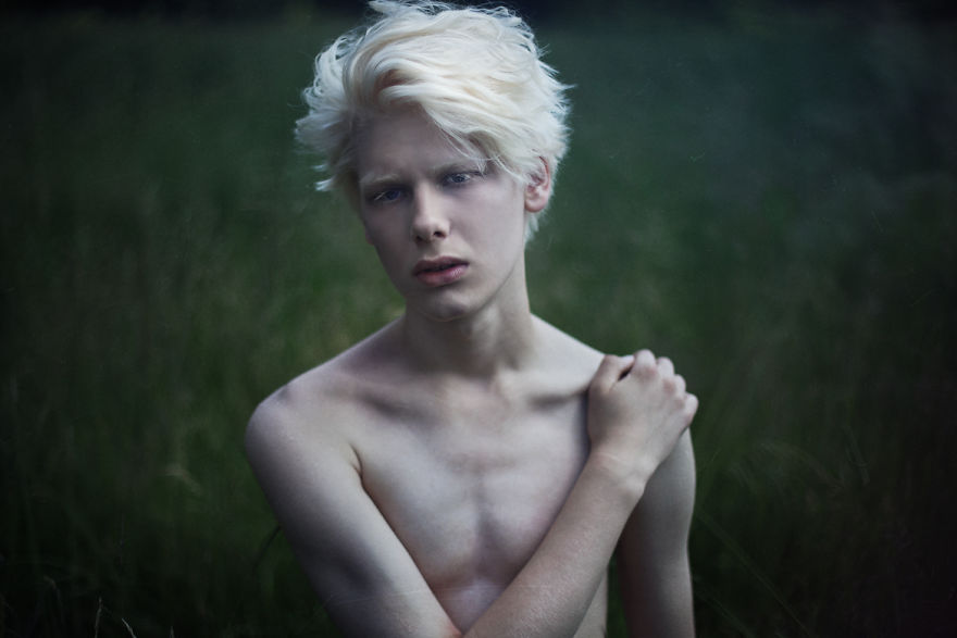 Sonstige Besonderheiten Beautiful-albino-peopheciu